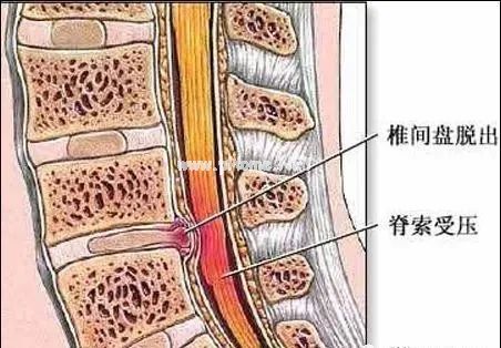 为什么脖子发硬一转就嘎巴响