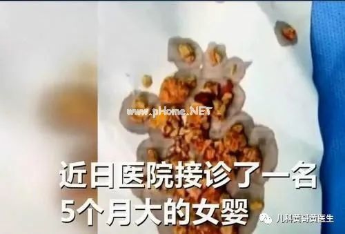 出生百日婴儿“开荤”被紧急送医抢救，这种陋习得改了
