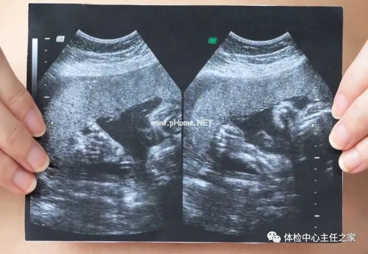 X线、CT、B超及核磁有啥区别？最适合检查哪些部位？
