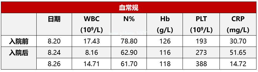 患儿出现发热、皮疹伴结膜充血,别遗漏了不完全川崎病 患儿出现发热、皮疹伴结膜充血,别遗漏了不完全川崎病