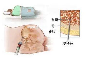 「血癌」专挑孩子下手？血常规报告上有这3种箭头，要当心