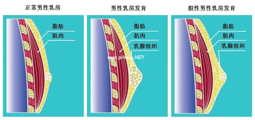 ​青春期男孩乳房发育直径长达4cm，是性早熟还是另有原因？