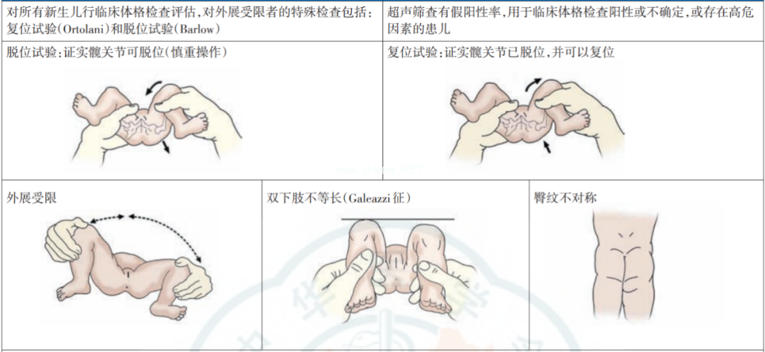 宝宝臀纹不对称需要考虑这个疾病，警惕两个危险因素！