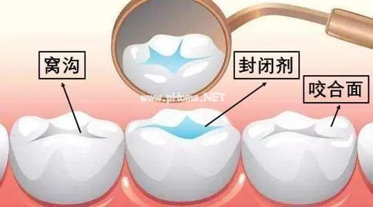 牙齿:“我很坚硬,也很脆弱,关于我的这5件事你都知道吗?” 牙齿:“我很坚硬,也很脆弱,关于我的这5件事你都知道吗?”