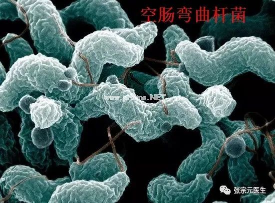 腹泻的常见病因有哪些【西医篇】