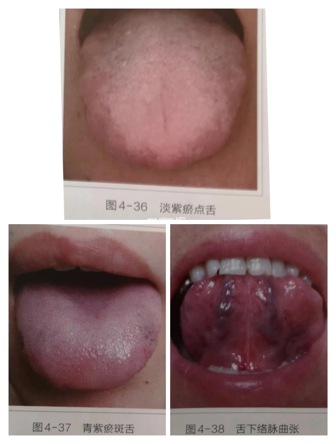 1分钟教你观舌术，附解决方法