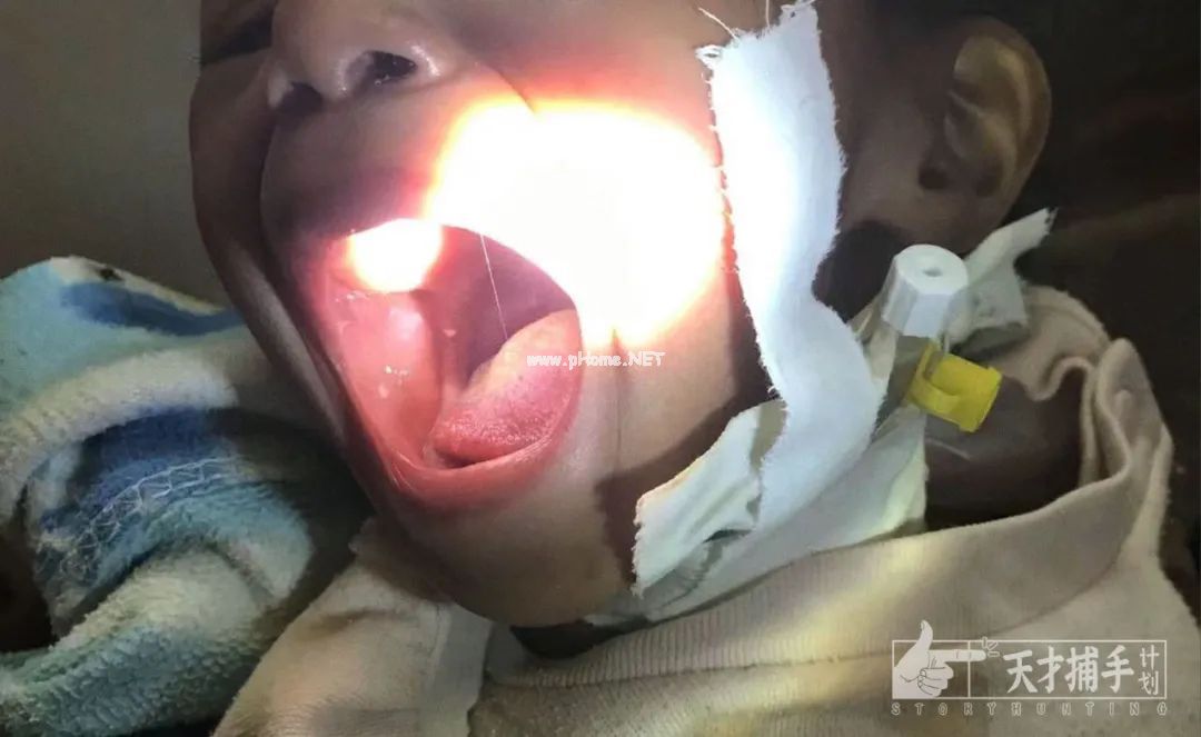 抗生素！抗生素！孩子连续八天高热，除了抗生素难道医生就不会开药了吗？（医生日记）