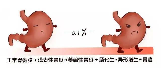 一个治疗慢性萎缩性胃炎的神药——摩罗丹