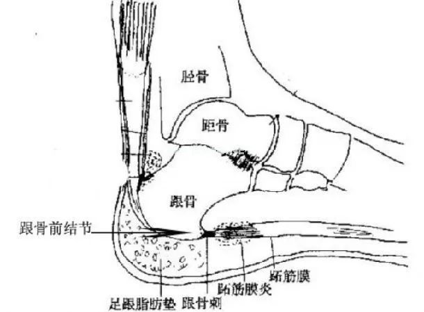 为让女儿长高,每天逼其跳绳3000个,孩子走路直说疼…… 为让女儿长高,每天逼其跳绳3000个,孩子走路直说疼……