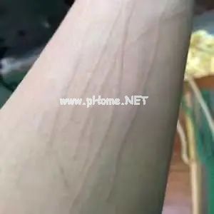 当心！这个春季常见病专挑孩子下手，一定要尽早预防！（不是手足口）