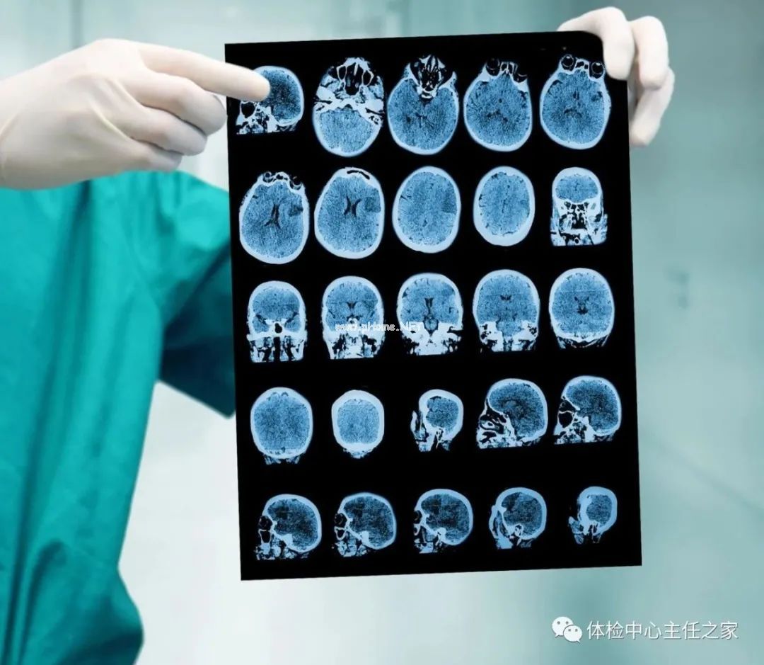 X线、CT、B超及核磁有啥区别？最适合检查哪些部位？