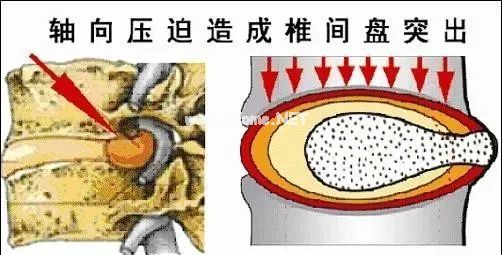 为什么脖子发硬一转就嘎巴响
