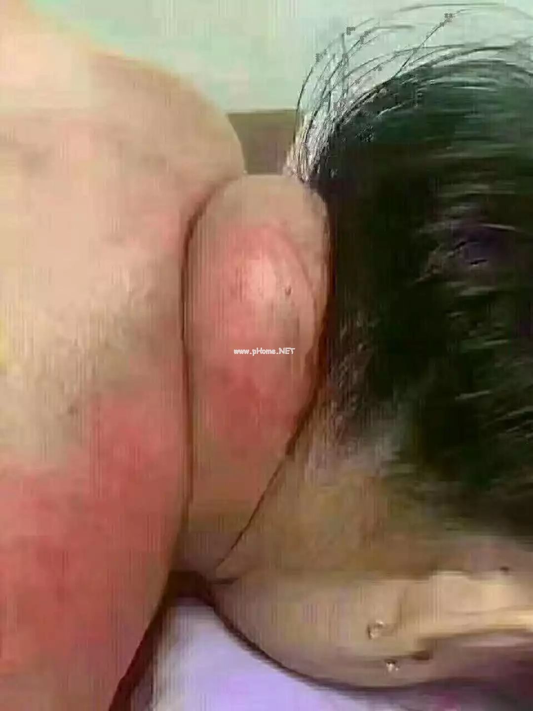 小心 “富贵包” 要了命！