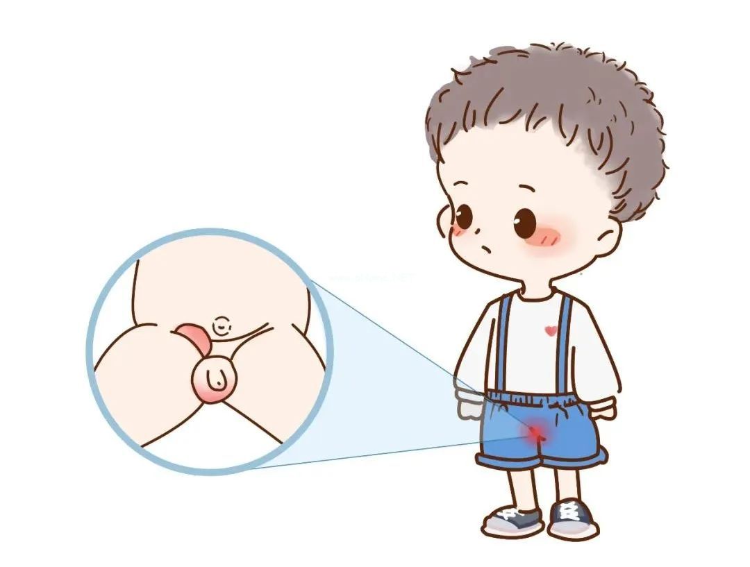 小儿腹痛查因阻碍重重?这份攻略请收好 小儿腹痛查因阻碍重重?这份攻略请收好