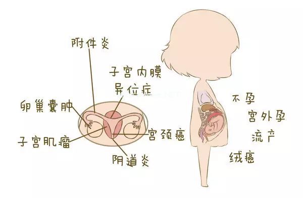 一张“女性妇科疾病地图”...