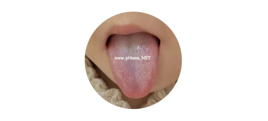 积、燥、湿困着孩子，煮起这碗汤！