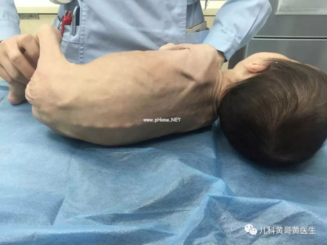 死神一步步逼近孩子，妈妈是坚持还是放弃？