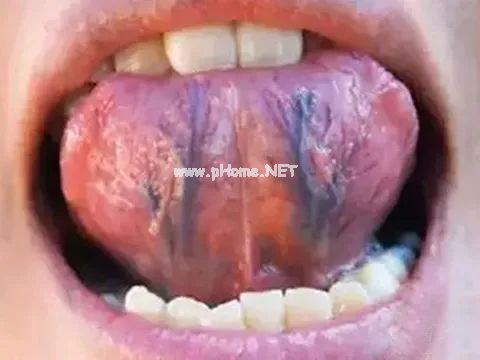 舌头一旦出现这个信号:重视一下。 舌头一旦出现这个信号:重视一下。
