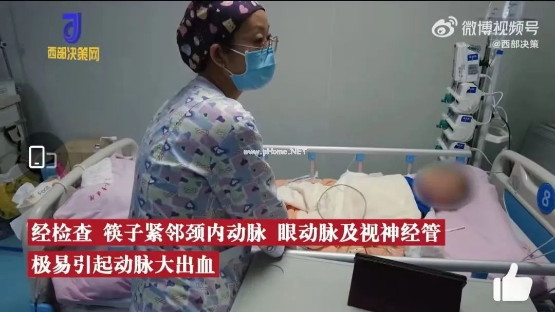 2岁幼童颅内插入筷子险丧命！家里这6类不起眼的东西，千万让娃远离！