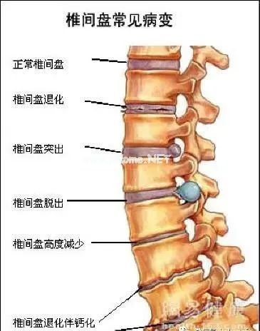 为什么脖子发硬一转就嘎巴响