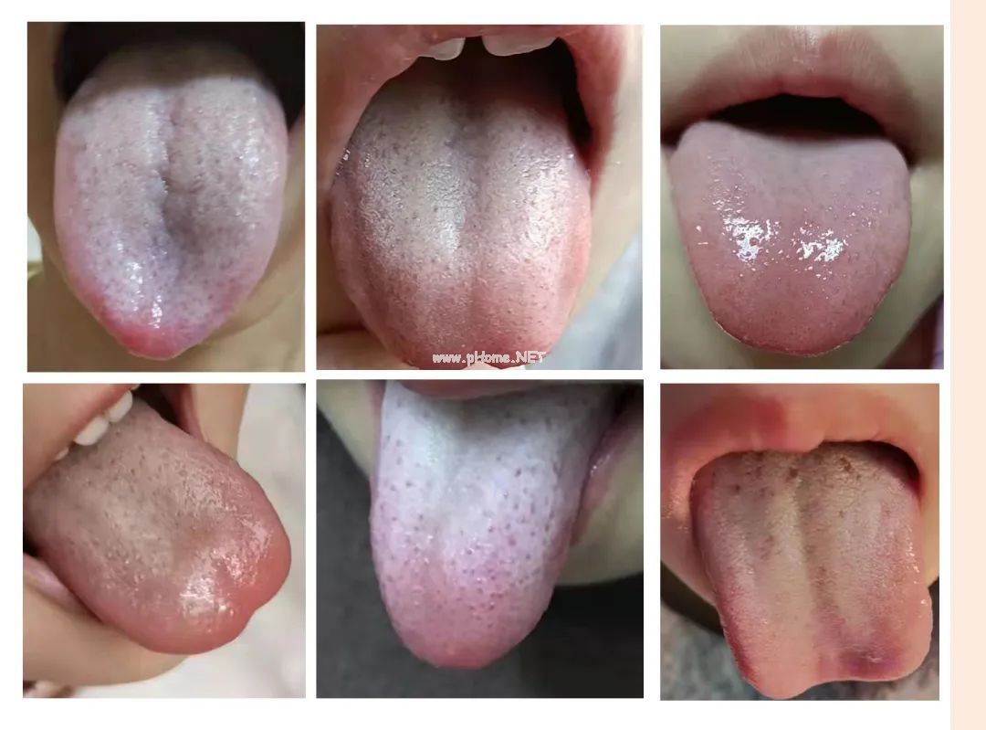 孩子有没有湿气？如何判断？