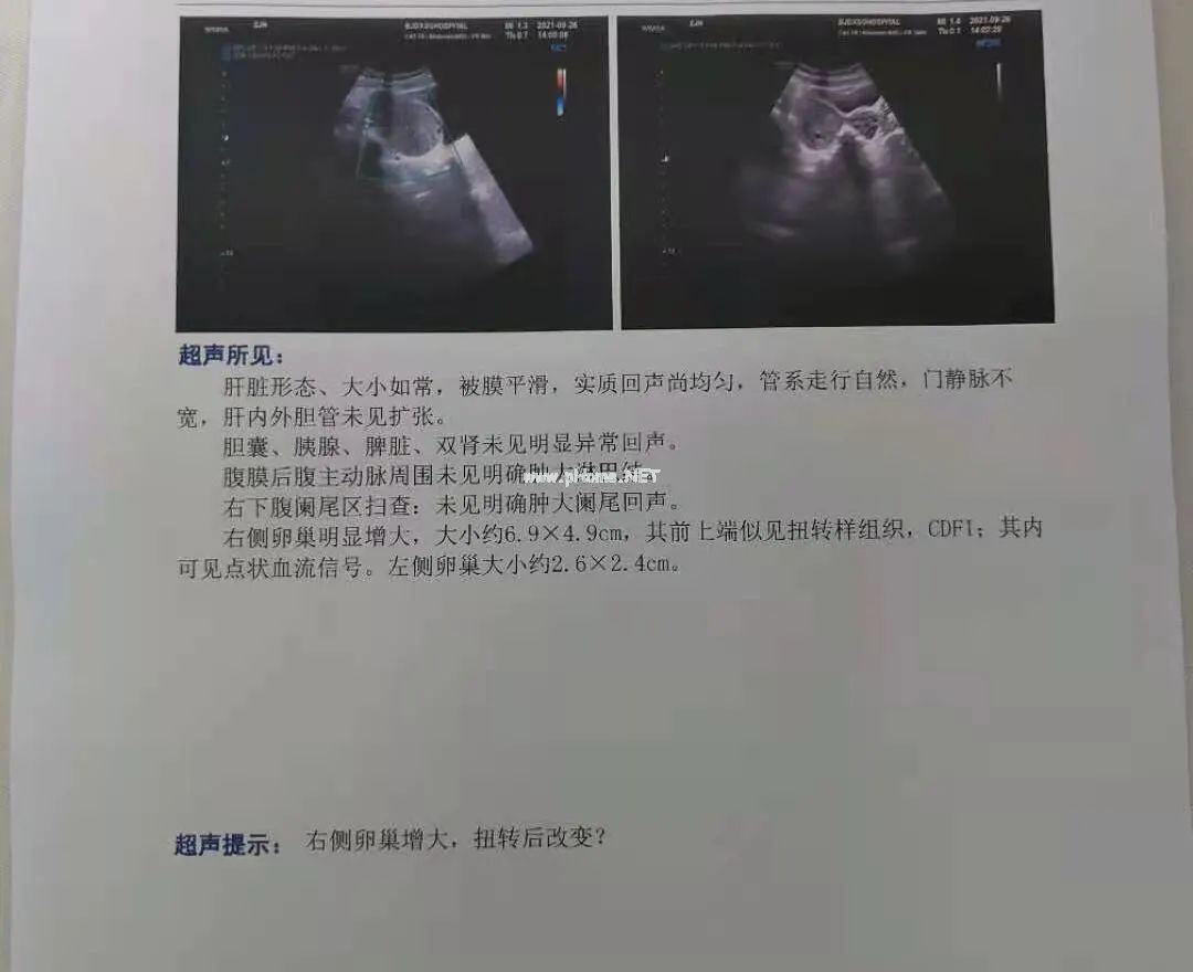 3个娃娃都“肚子痛”，医生却给了不同的诊断，为啥？