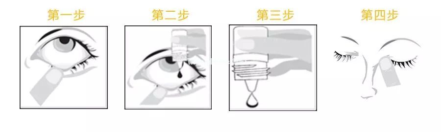 【每日一药】氟米龙滴眼液（氟美童、艾氟龙等）