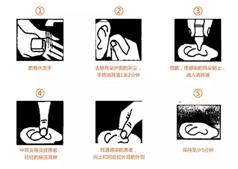 【每日一药】氧氟沙星滴耳液