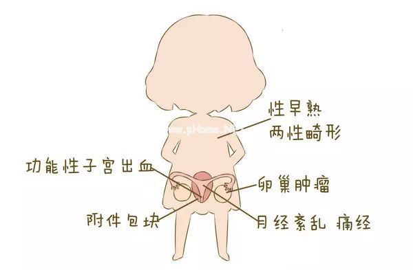 一张“女性妇科疾病地图”...