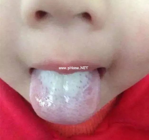 舌头一旦出现这个信号:重视一下。 舌头一旦出现这个信号:重视一下。