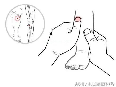 如何科学看待猪毛风，程老师详细介绍“小儿猪毛风”的前世今生