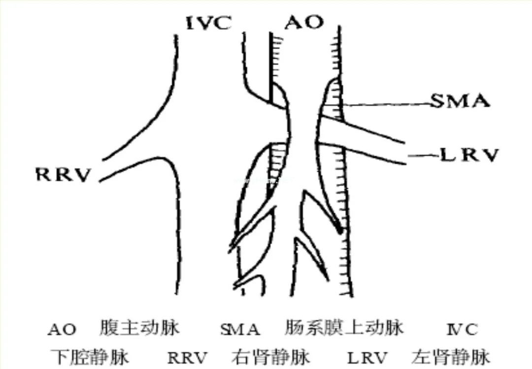 男孩出现皮疹、血尿……不注意这个细节，误诊几率大