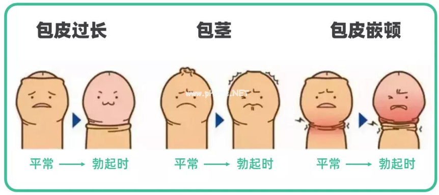 小鸡鸡长度也有国际标准 !  低于这个数，得赶紧看医生