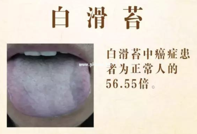 两种舌象：可能是癌症高危人群？
