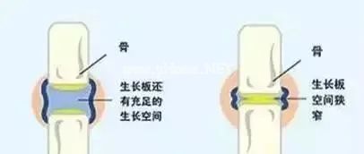 为让女儿长高,每天逼其跳绳3000个,孩子走路直说疼…… 为让女儿长高,每天逼其跳绳3000个,孩子走路直说疼……
