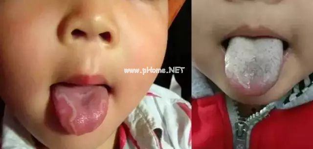 一位女中医的愤怒：阴寒、错误的生活方式，导致全民虚寒