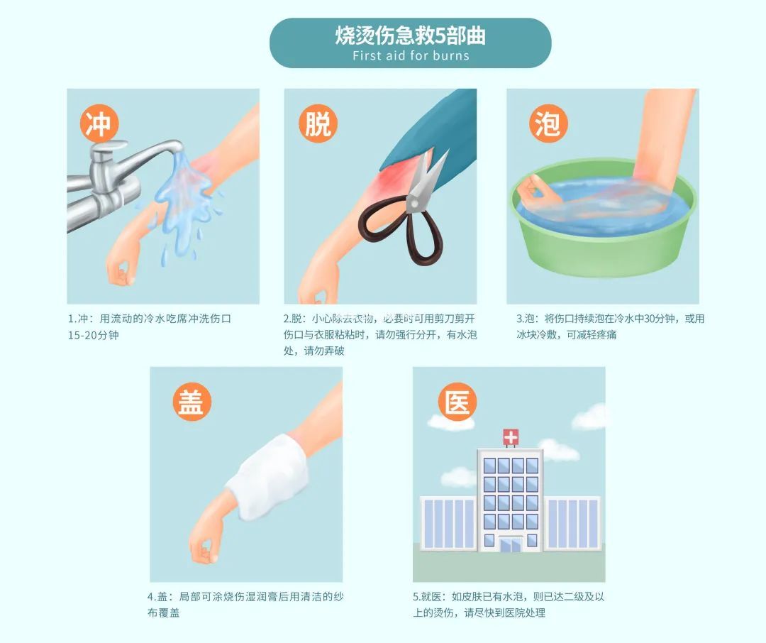 意外烧、烫伤该怎么办？ 华西专家：记住5字秘诀（老辈子带娃必看）