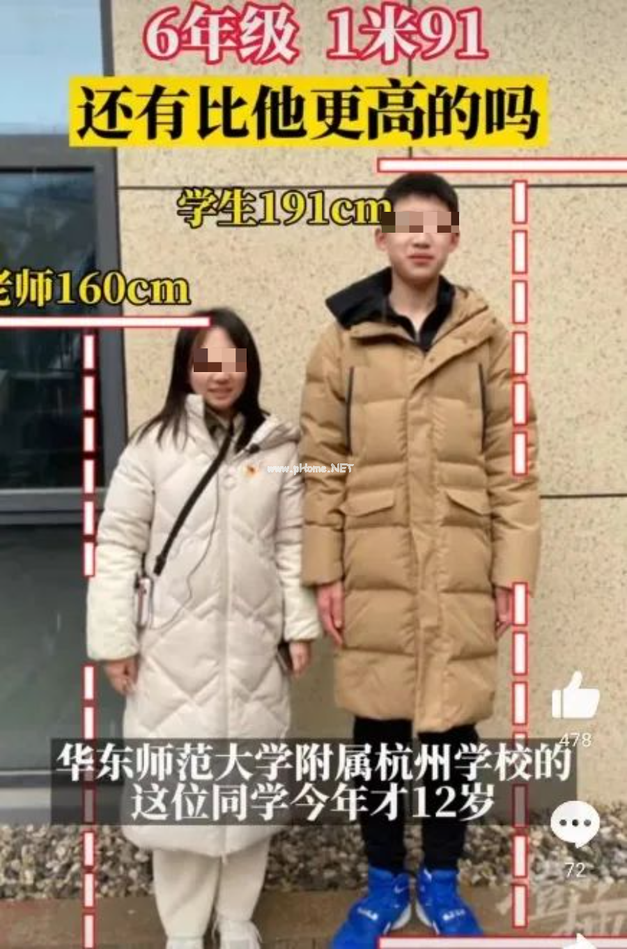 12岁195cm,专家提醒:长太快不一定是好事 12岁195cm,专家提醒:长太快不一定是好事