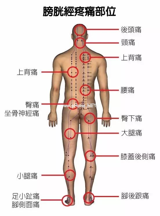 最全身体疼痛对照表，看看你到底是哪儿堵了？