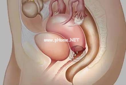 女人如果没了子宫，你绝对想象不到……