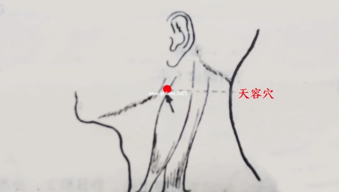 容易咽喉肿痛的孩子，记住两个穴位！