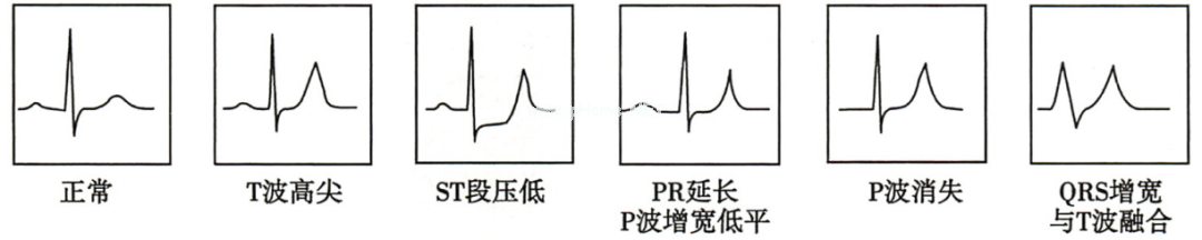 儿童血钾紊乱不知如何处理？从分类到治疗一文搞定！（上）