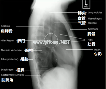 读完此文，终于会看儿童胸片了！