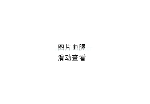 双胞兄弟“宫斗”，最终两败俱伤……