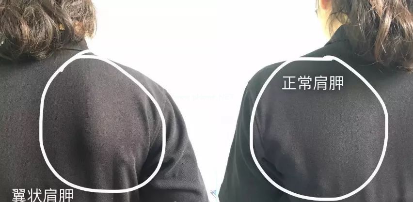 这不是性感！是有病！