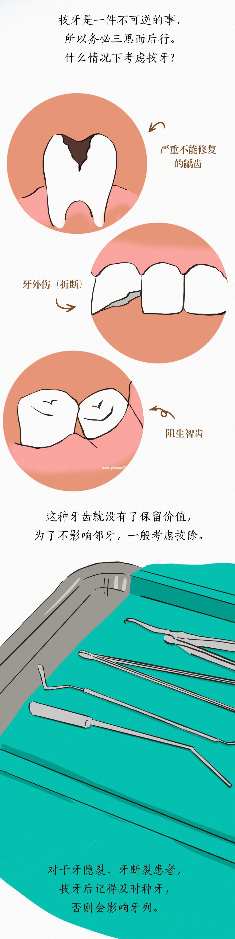 人类「拔牙」趣味简史