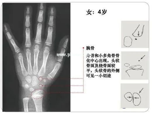 这样的身高预测算法靠谱吗? 这样的身高预测算法靠谱吗?