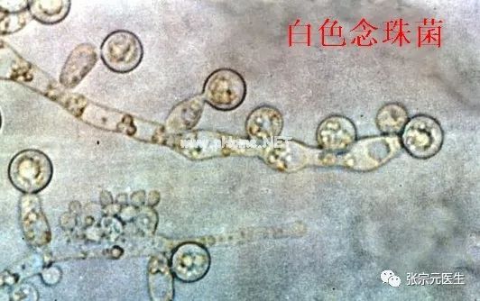 腹泻的常见病因有哪些【西医篇】
