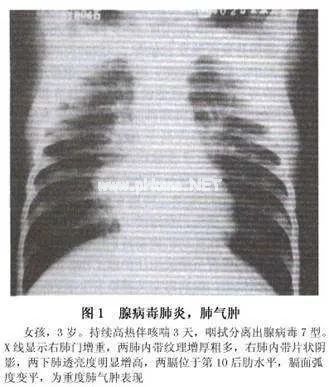 突发！又一地爆不明儿童肝炎！孩子有这6种情况马上就医！