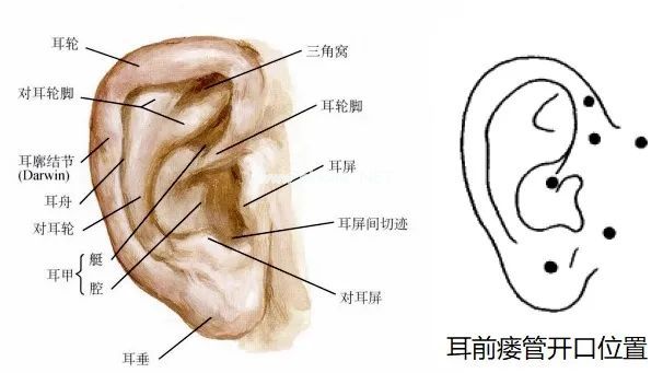 耳朵上有小孔和大舌头？需要当心！